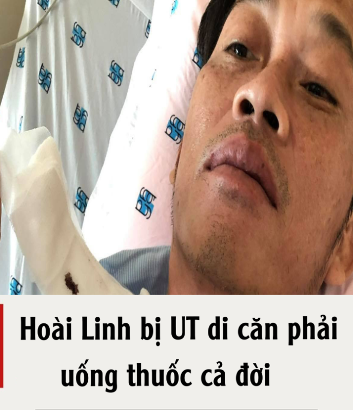 Hoài Linh Chính Thức bị ung thư di căn