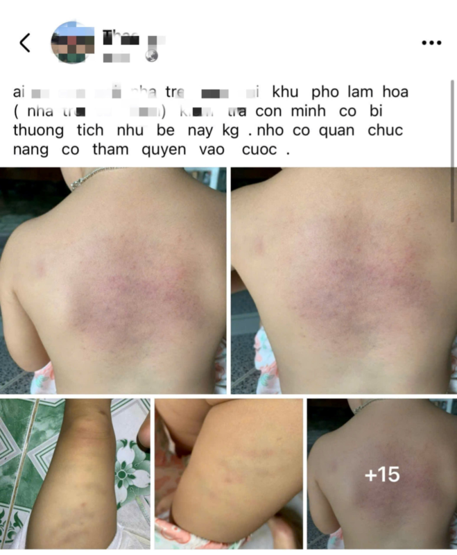 Bảo mẫu Dã Man Đánh Đập Trẻ Tại nhà trẻ tư thục